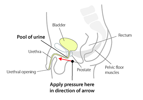 Post micturition diagram